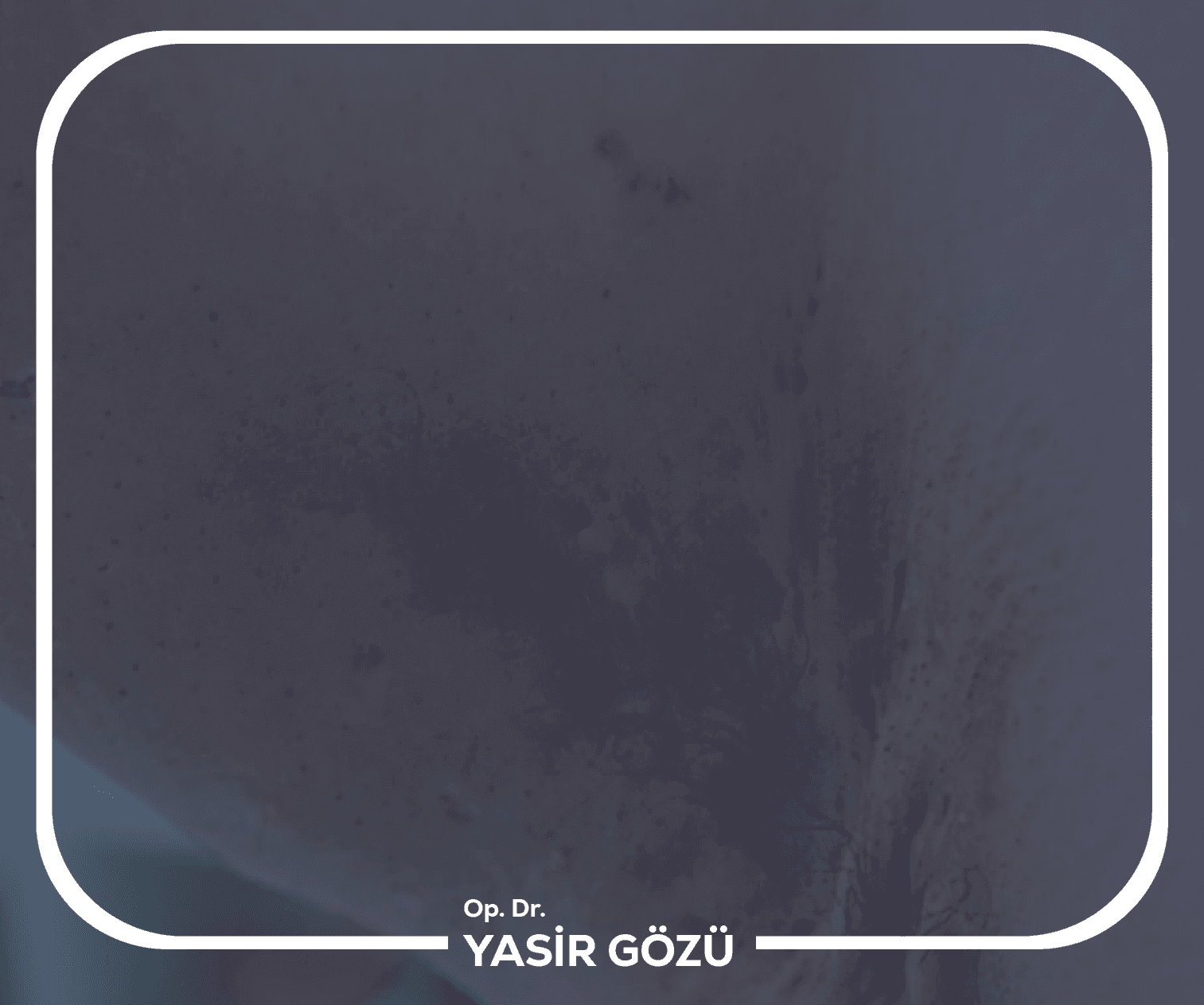 علاج التهاب الغدد العرقية القيحي بالليزر
