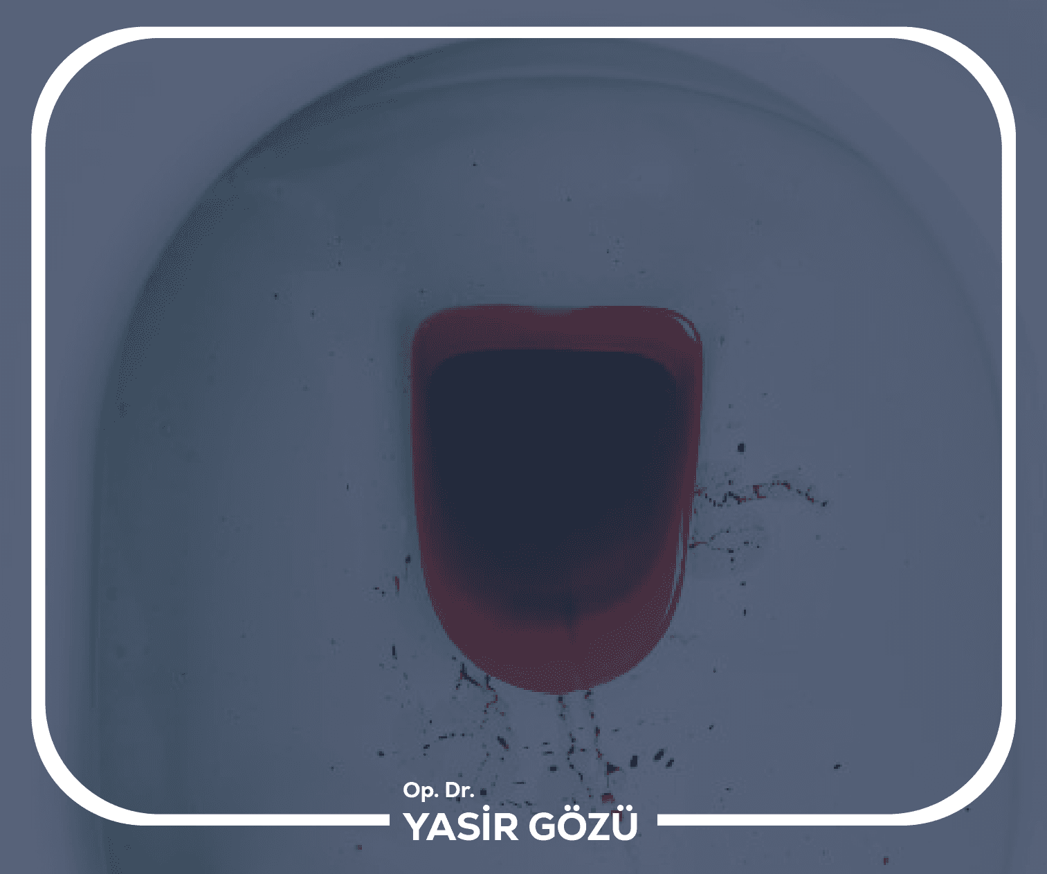 أعراض النزيف الشرجي