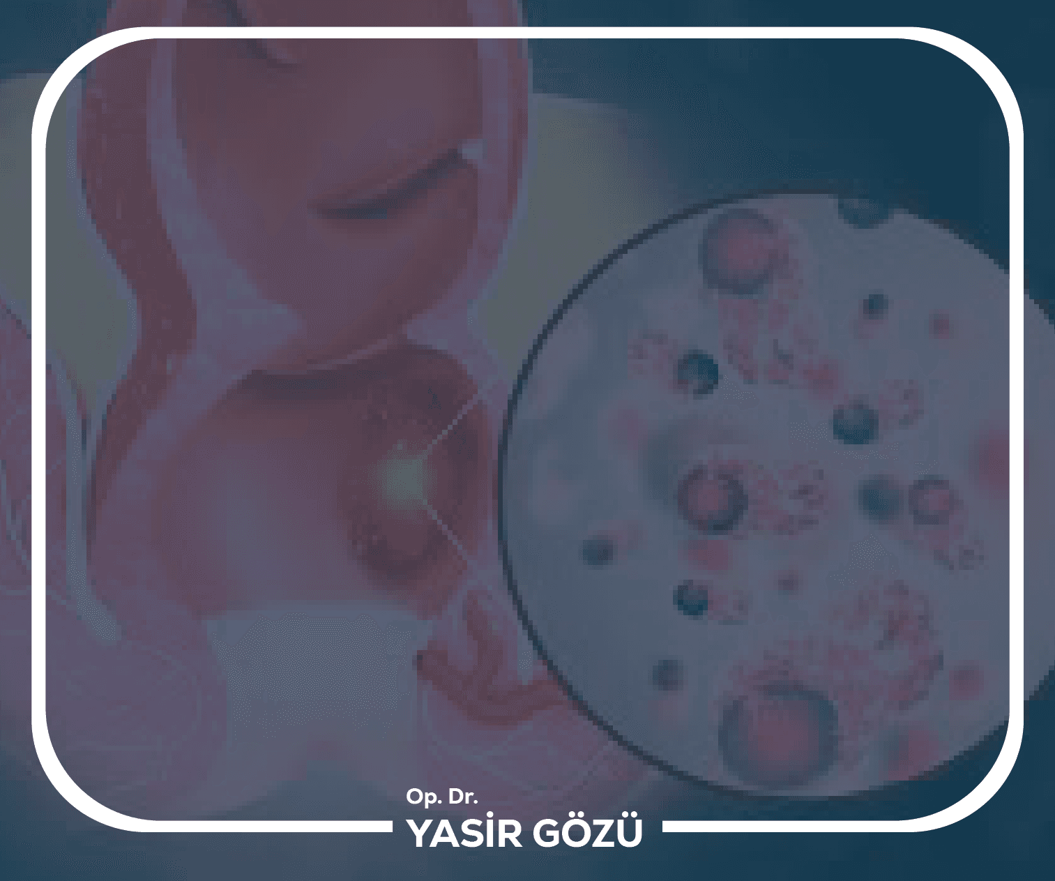 علاج خراج الشرج بالليزر