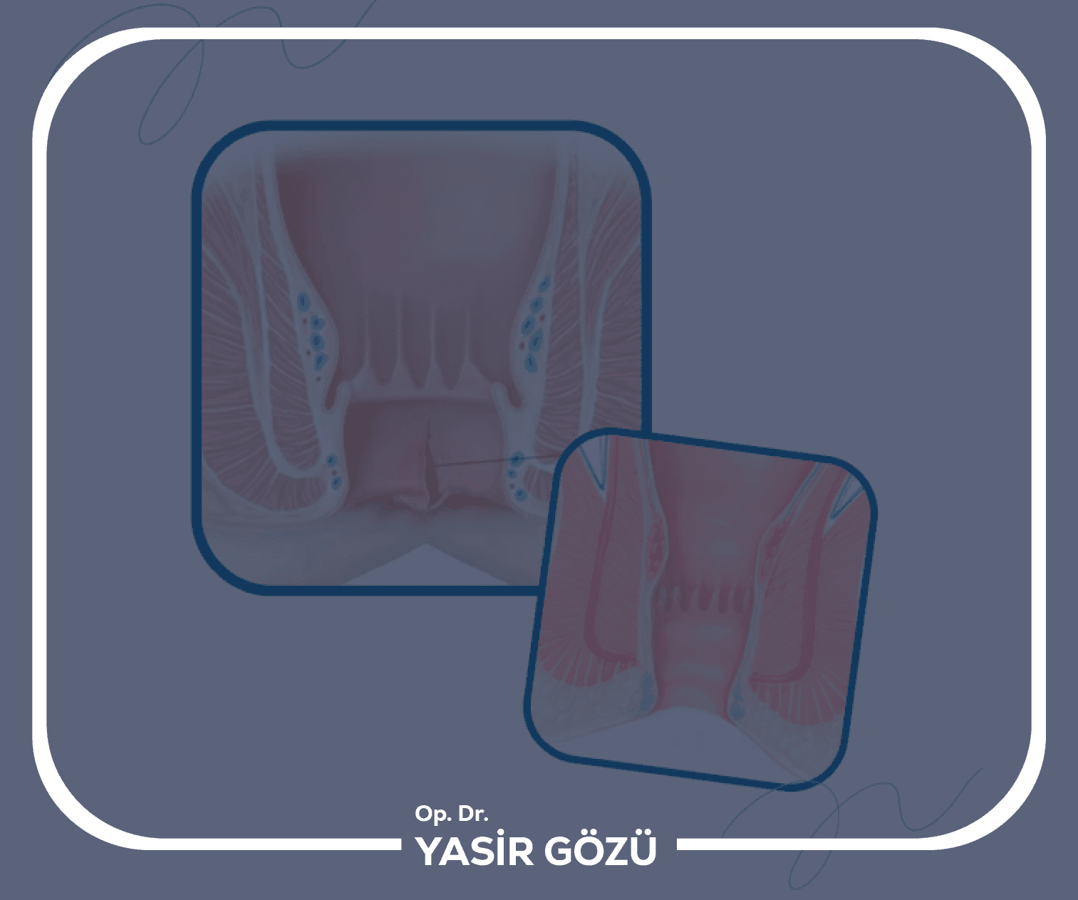 Makat Estetiği Neden Yapılmalı?