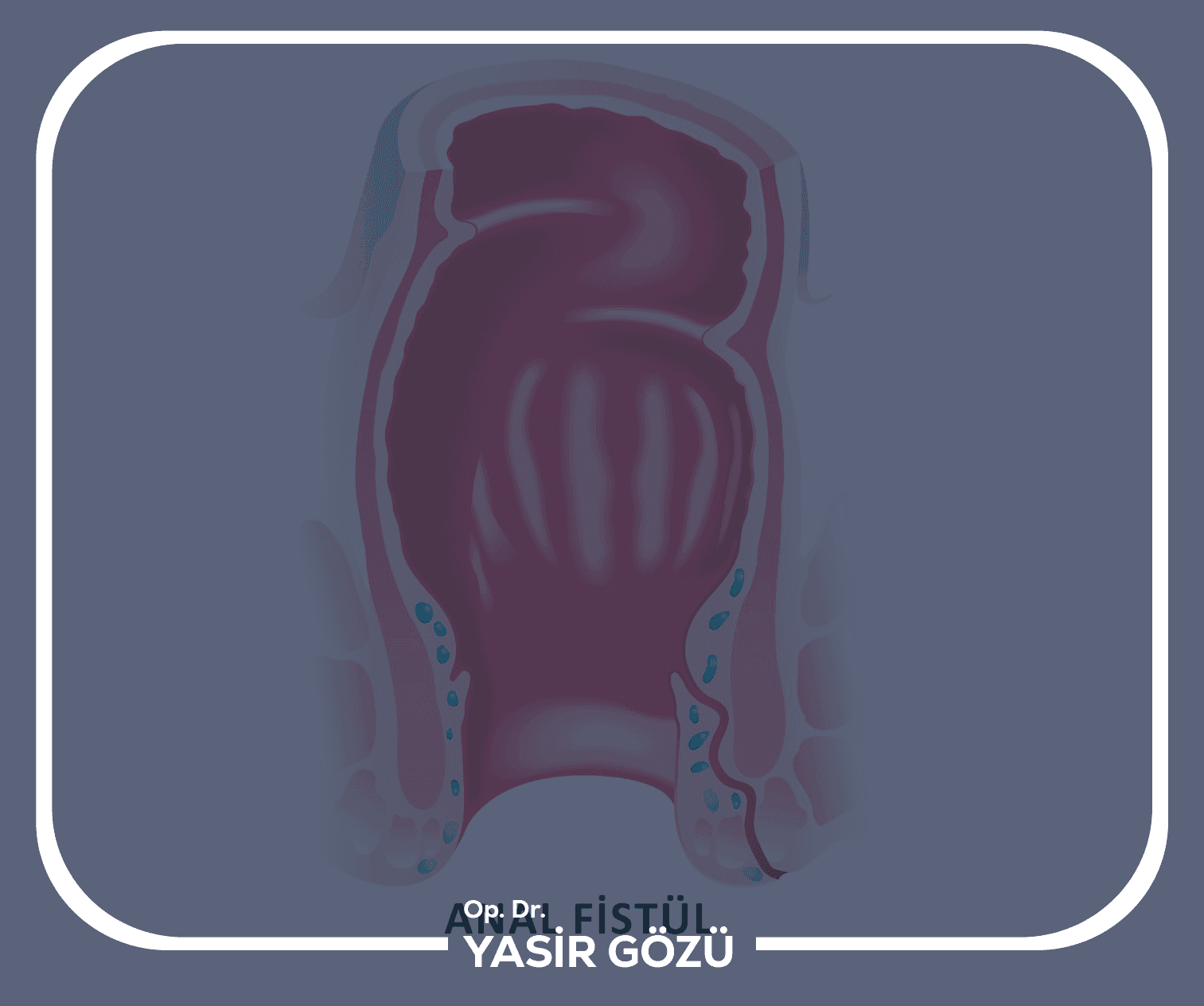 ما هو الناسور الشرجي؟