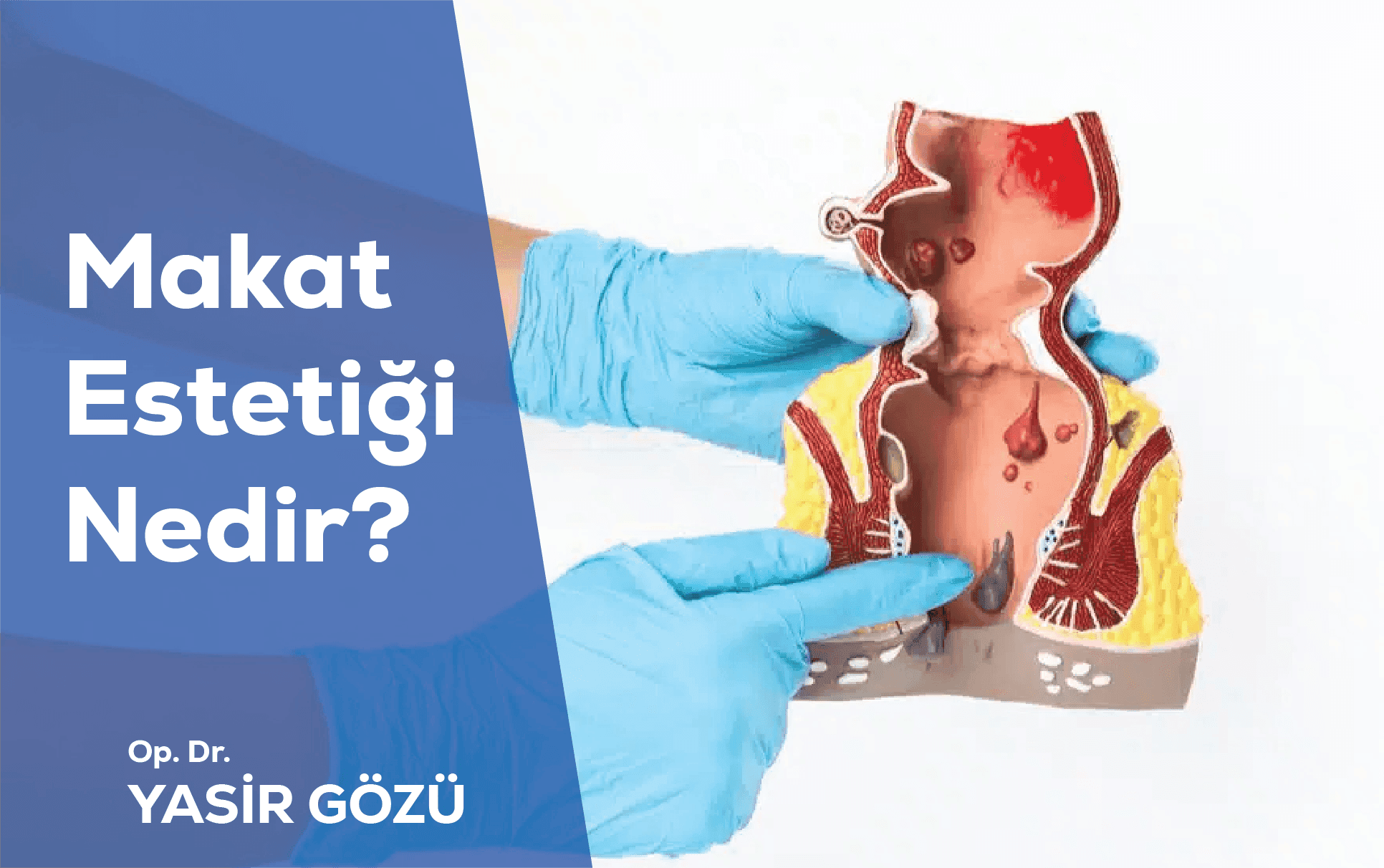 makat estetiği nedir