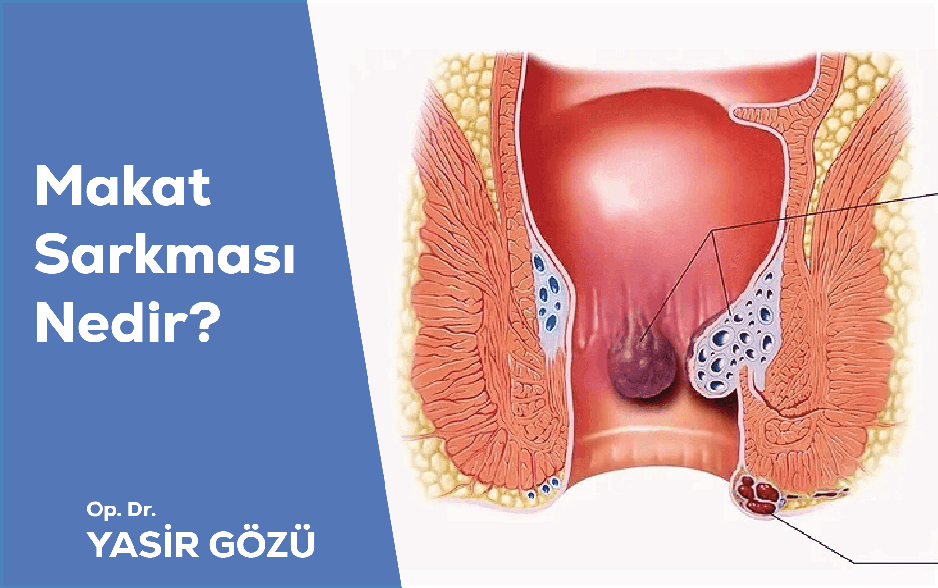 makat sarkması nedir