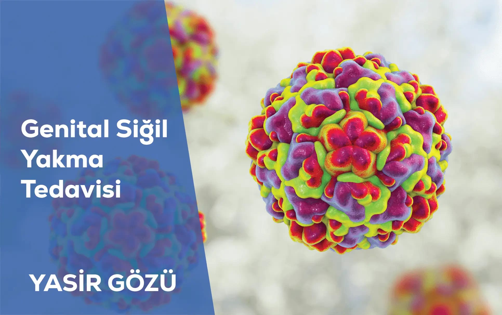 genital siğil yakma