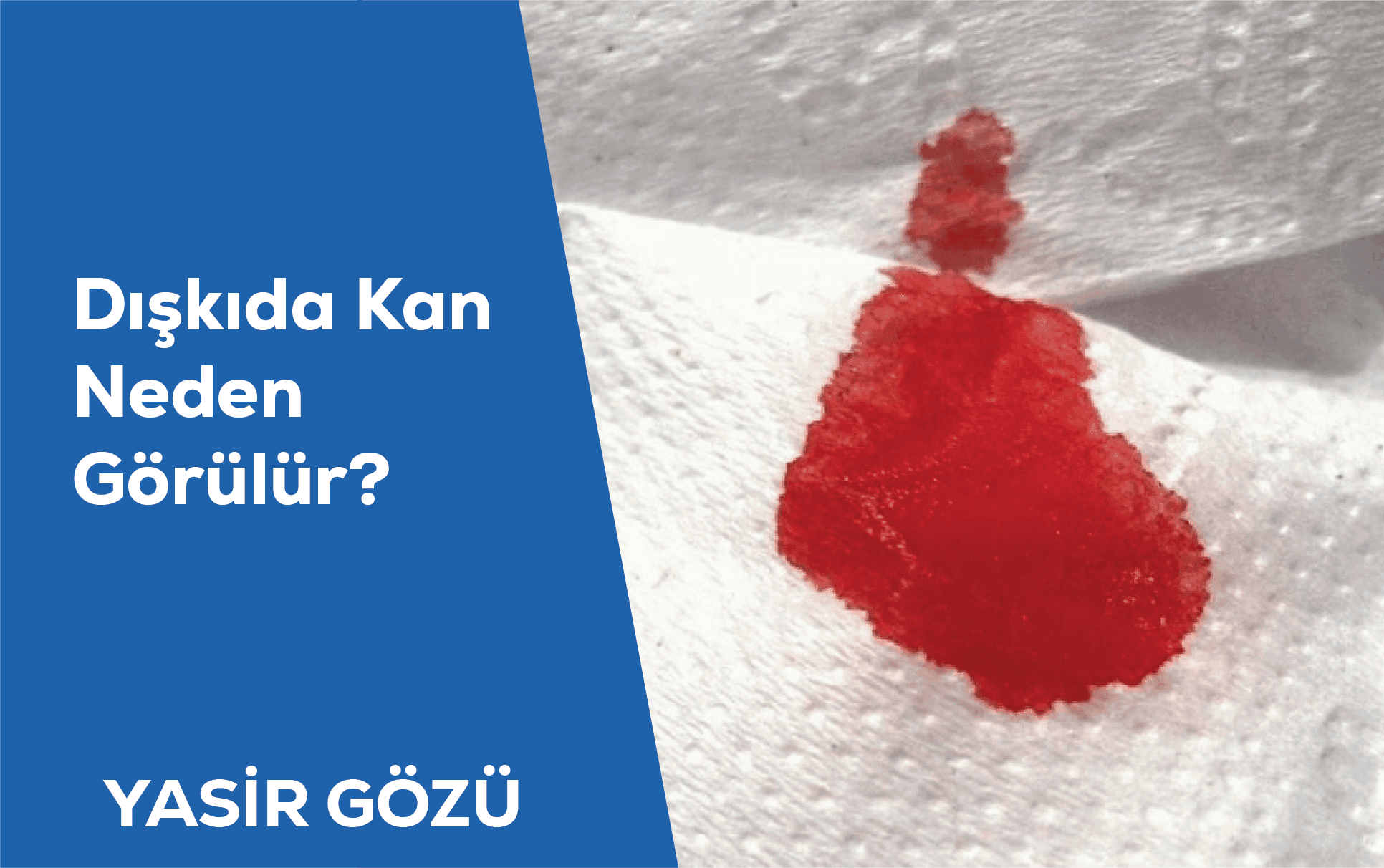blood in stool