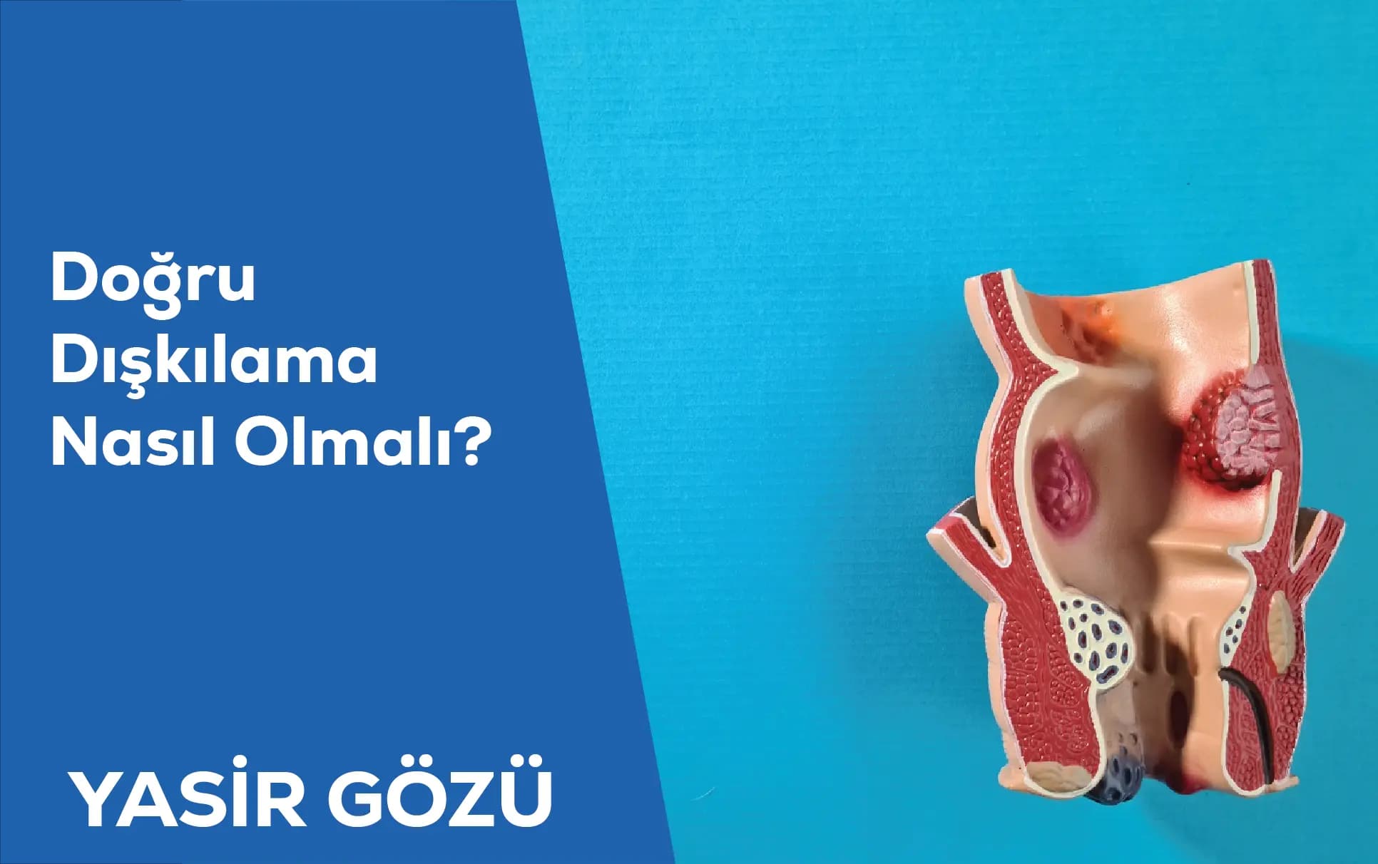 doğru dışkılama