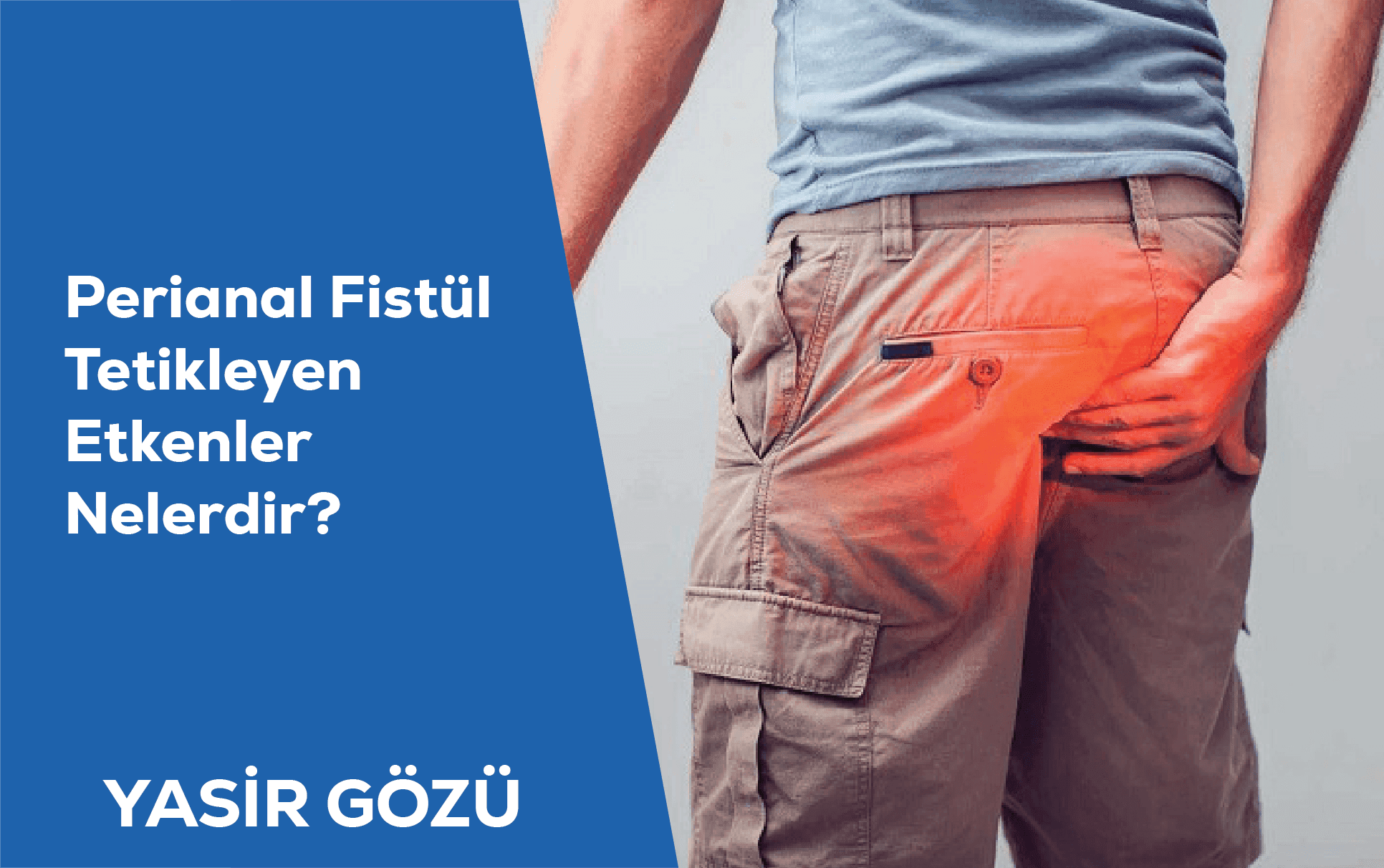 perianal fistula