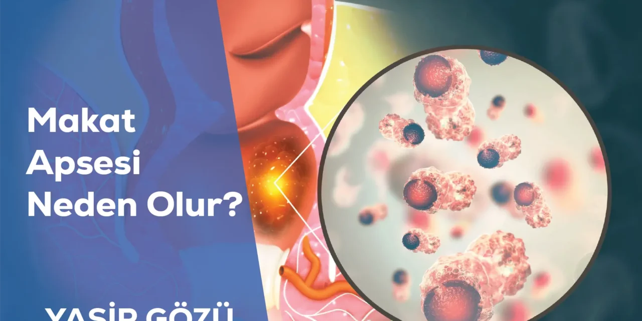 Makat Apsesi Neden Olur?