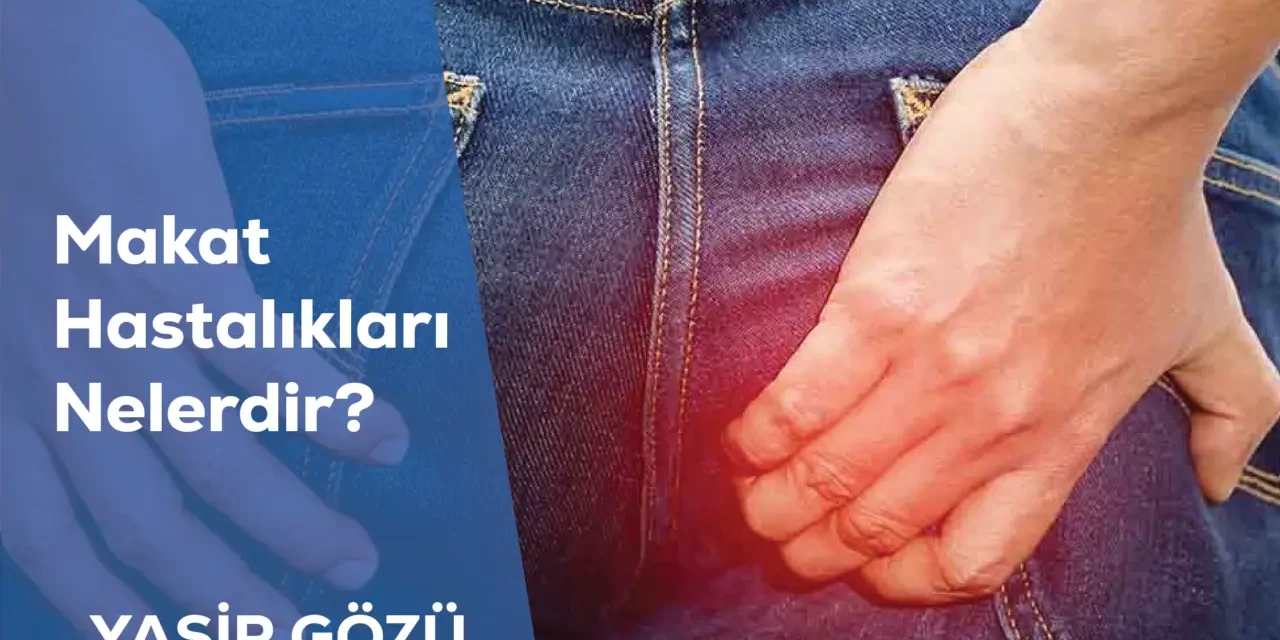 Makat Hastalıkları Nelerdir?