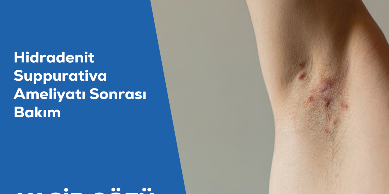 Hidradenit Suppurativa Ameliyatı Sonrası Bakım