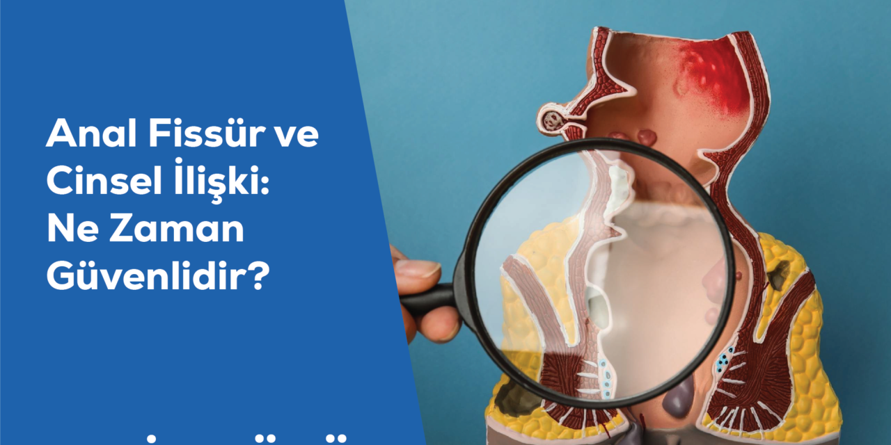 Anal Fissür ve Kabızlık İlişkisi