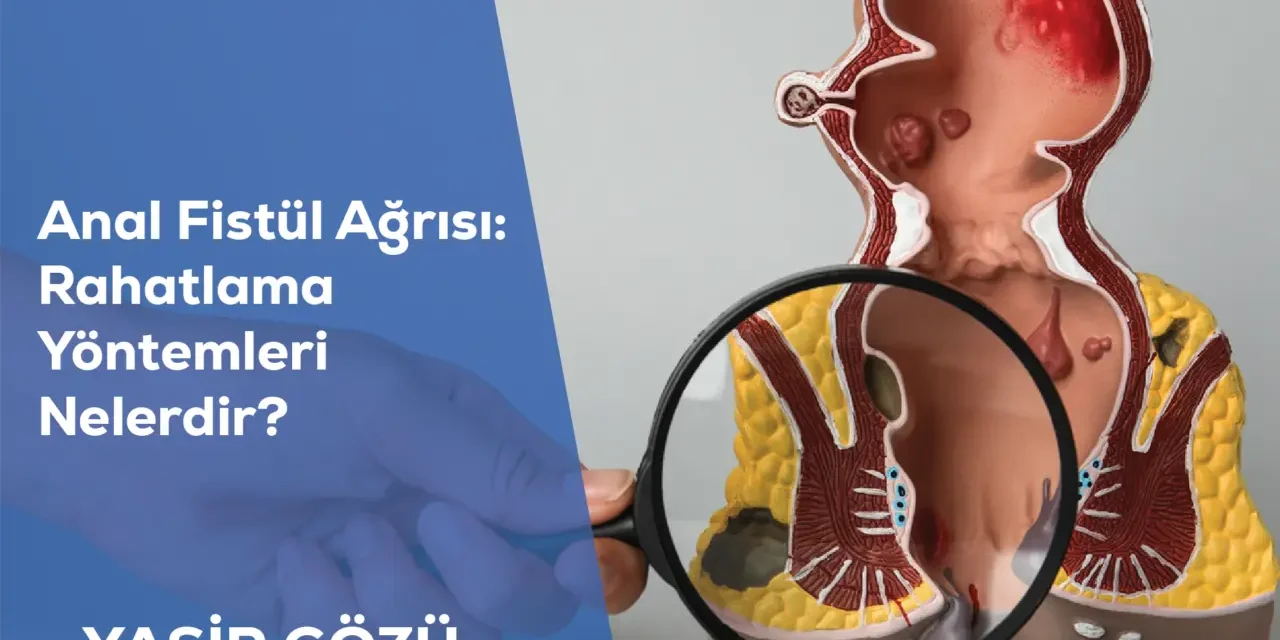 Anal Fistül Ağrısı: Rahatlama Yöntemleri Nelerdir?