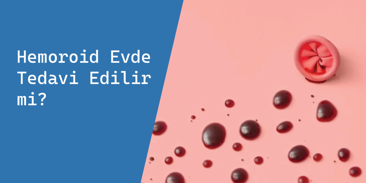 Hemoroid Evde Tedavi Edilir mi?