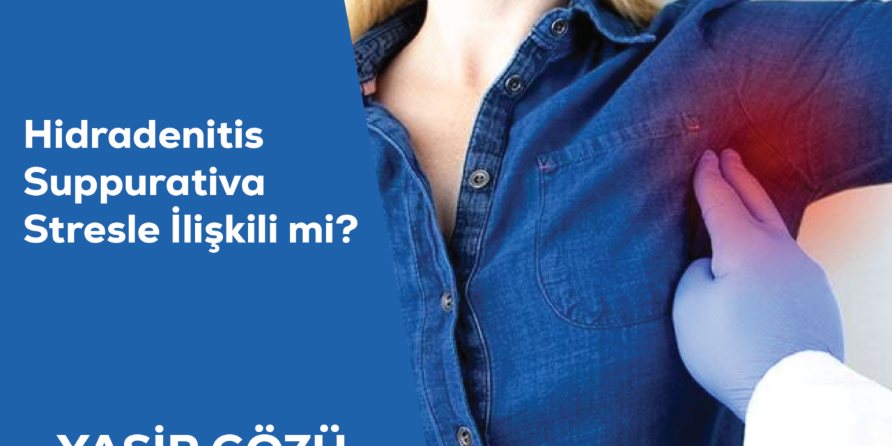Hidradenitis Suppurativa Stresle İlişkili mi?