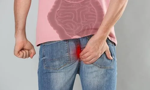 perianal fistül