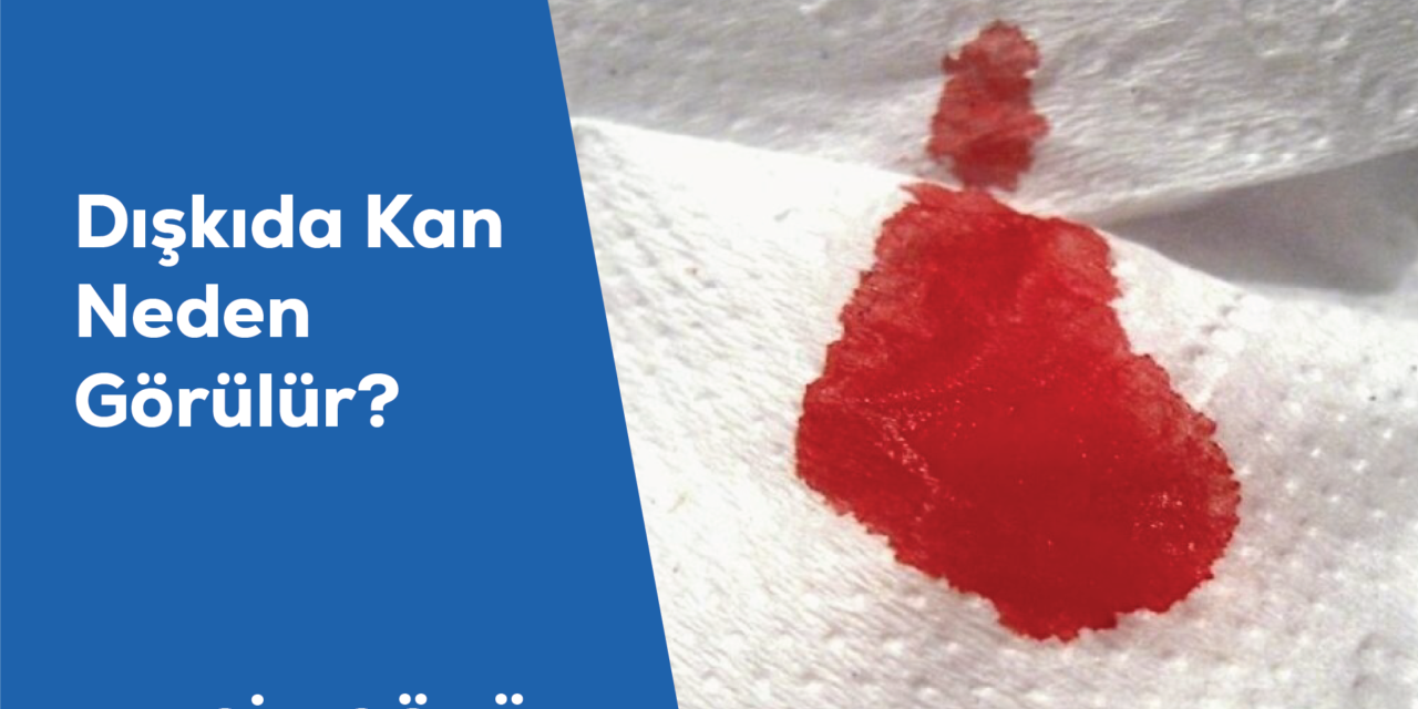 Dışkıda Kan Neden Görülür?