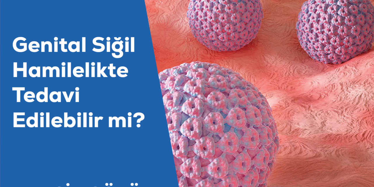 Genital Siğil Hamilelikte Tedavi Edilebilir mi?