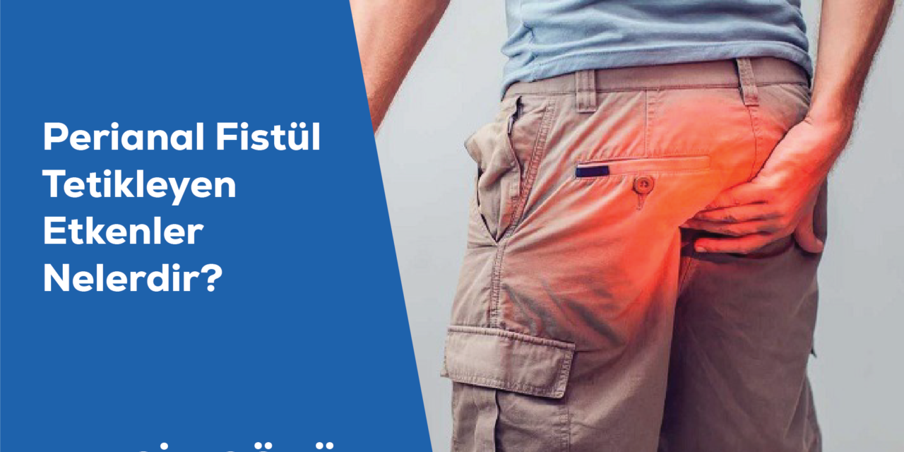 Perianal Fistül Tetikleyen Etkenler Nelerdir?