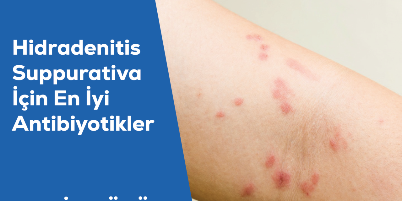 Hidradenitis Suppurativa İçin En İyi Antibiyotikler