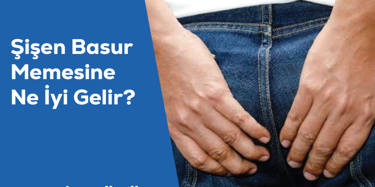 Şişen Basur Memesine Ne İyi Gelir?